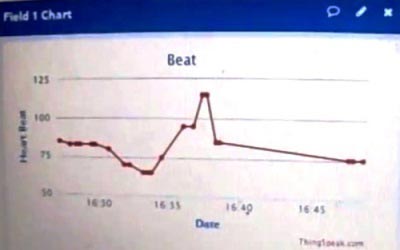 کنترل ضربان قلب با استفاده از آردوینو در بستر اینترنت اشیا (ThingSpeak)
